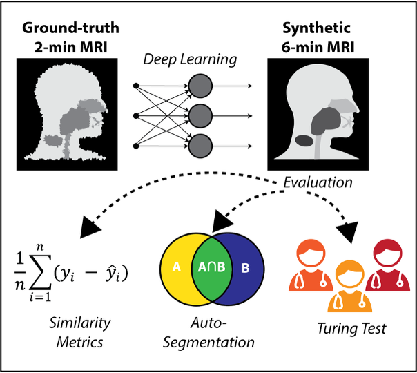Low-Quality to High-Quality MRI Generation